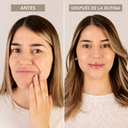Trío Intensivo  — Trata, Regenera y Protege
